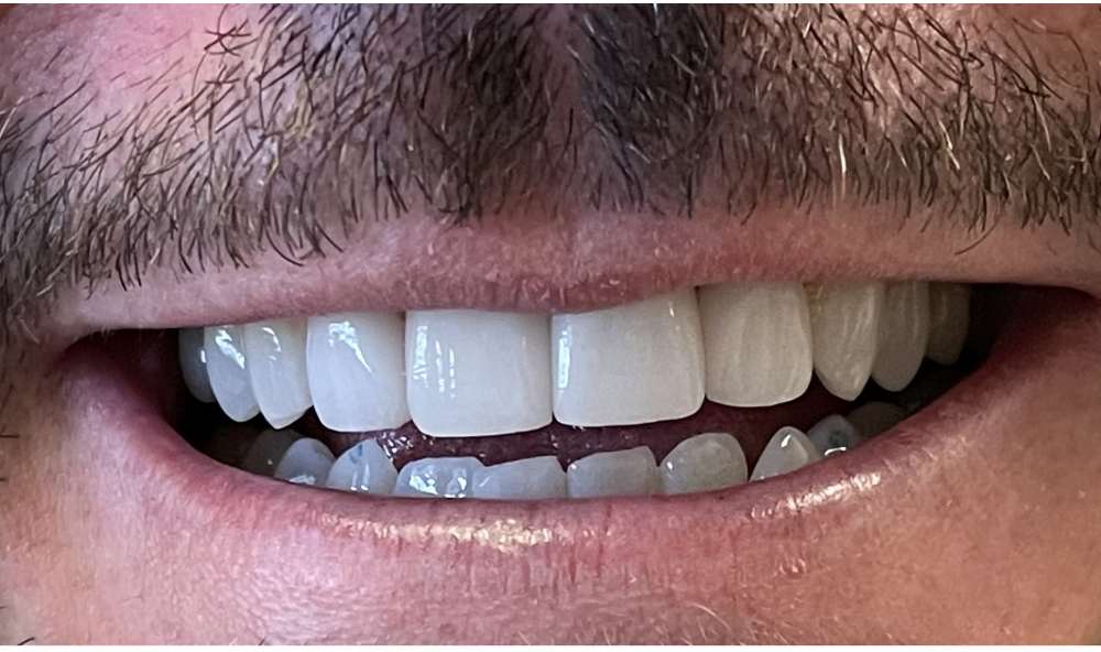 After Image: case 3