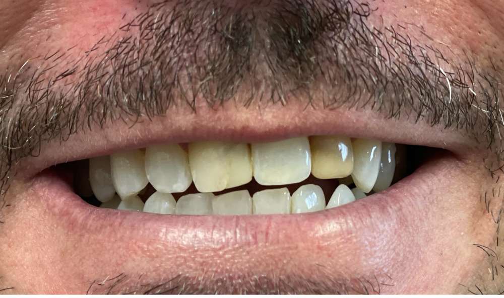 Before Image: case 3