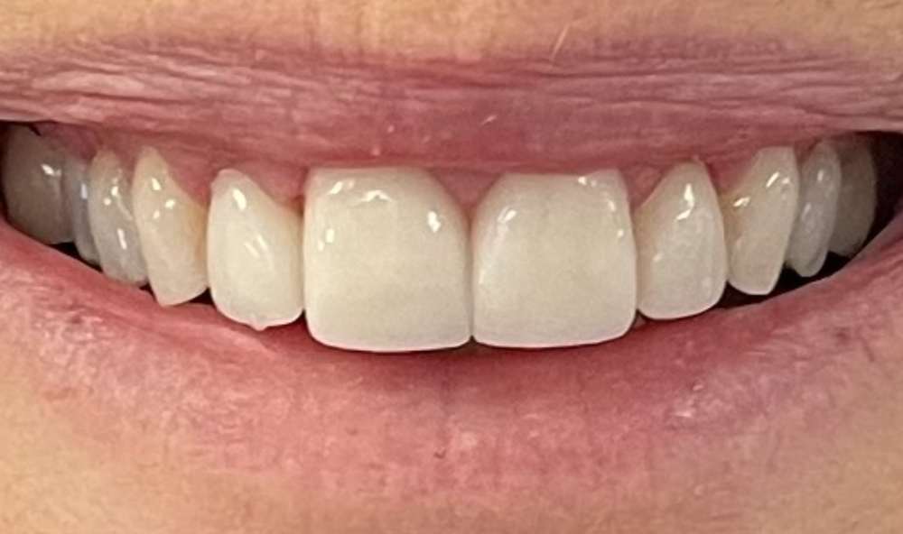 After Image: case 4