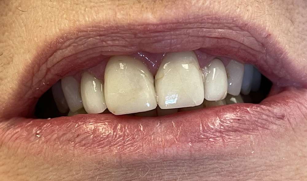 Before Image: case 4