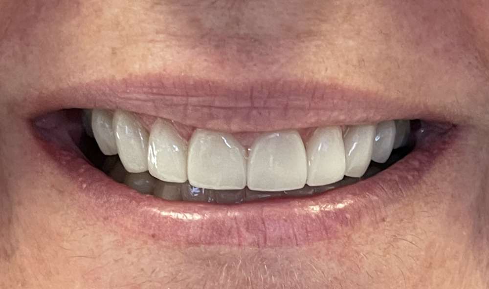 After Image: case 5