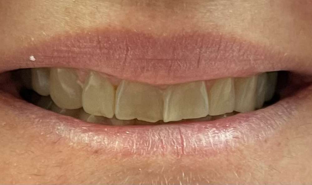 Before Image: case 5